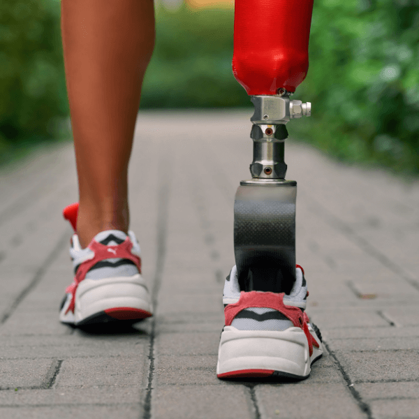 Frauenbeine von hinten mit Prothese beim Spazierengehen - Orthopädietechnik Nord macht SIe mobil